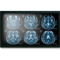 Onyx MEDDP-622HNN 21.5" Medical Display