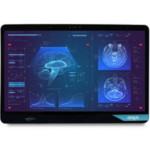 Onyx VENUS-244-G35 I5-1135G7 24" Medical Cart Pc
